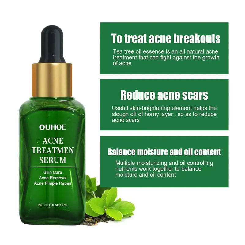 Acne Treatment Facial Serum Pore Shrinking Skin Care