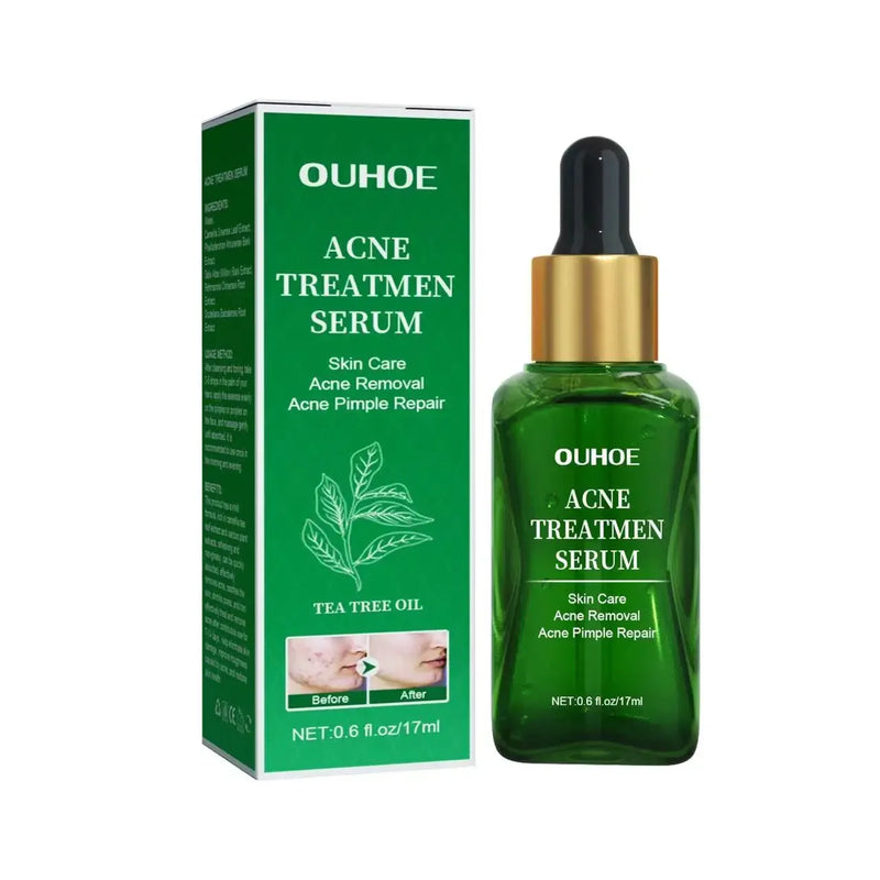 Acne Treatment Facial Serum Pore Shrinking Skin Care